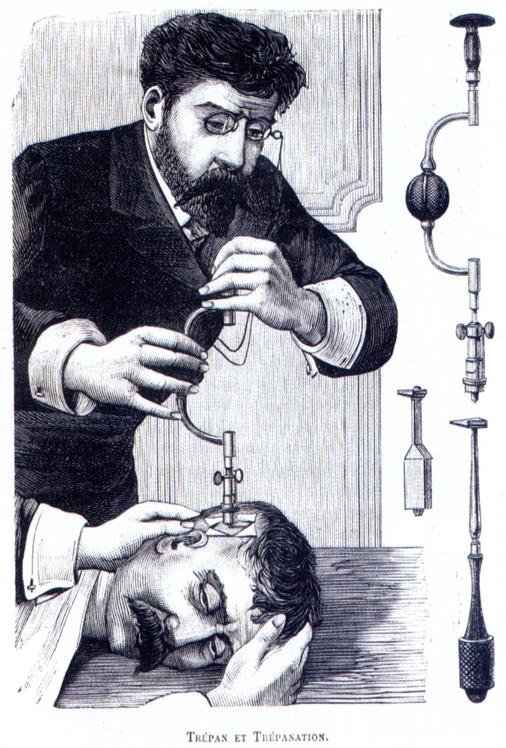 Trepanation. This therapy holds that insanity is caused by demons lurking inside the skull. Boring a hole in the patient’s head creates a door through which the demons can escape, and – viola! – out goes the crazy.